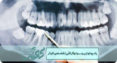 رادیوگرافی پانورکس