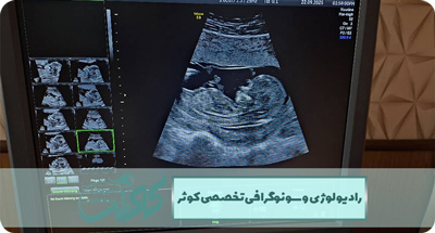 سونوگرافی بارداری